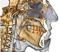 Invivo5 – высокопроизводительное ПО для 3D визуализации